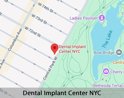 Map image for All-on-4® Implants in New York, NY