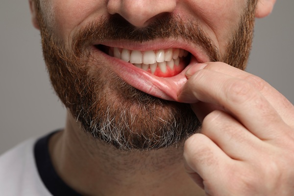 How Adding A Deep Cleaning Toothbrush To Your Oral Hygiene Routine Can Fight Off Gum Disease